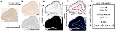 Young COVID-19 Patients Show a Higher Degree of Microglial Activation When Compared to Controls